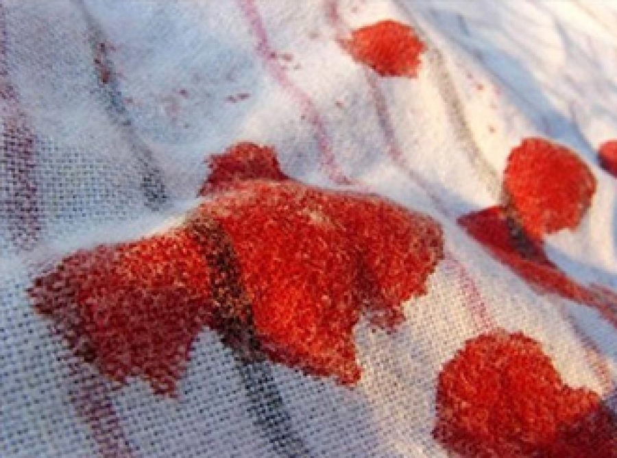 Удалить пятно крови с дивана подручными средствами